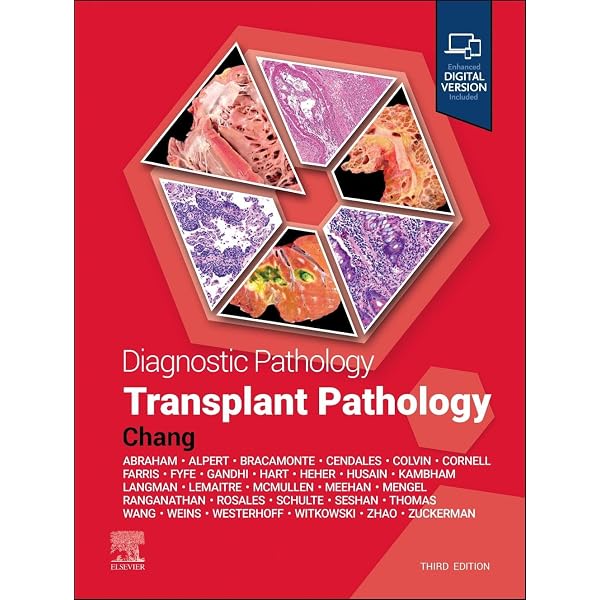 Amazon | MacSween's Pathology of the Liver | Burt BSc MBChB MD
